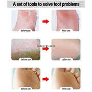 Ponceuse à pied en Acier inoxydable; Dissolvant de Râpe Pied (CMER)